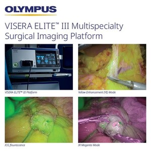 Olympus Launches Next-Generation Surgical Imaging Platform in U.S.
